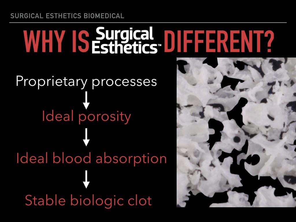 Bone Graft Quality | Surgical Esthetics | Surgical Esthetics Bone Graft Bone Graft Quality | Surgical Esthetics | Surgical Esthetics Bone Graft
