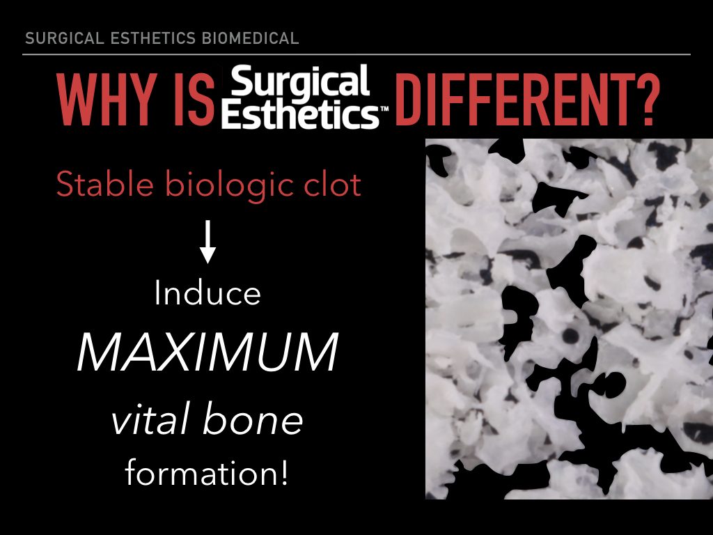 Bone Graft Quality | Surgical Esthetics | Surgical Esthetics Bone Graft Bone Graft Quality | Surgical Esthetics | Surgical Esthetics Bone Graft